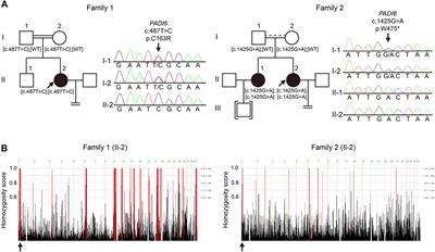 Novel Homozygous PADI6 Variants in Infertile Females with Early Embryonic Arrest